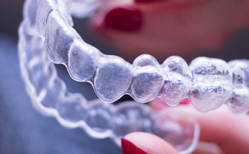 Advantages Of Eating With Invisalign