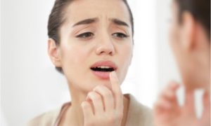 The woman needs a canker sore home remedy.