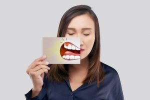 periapical abscess facial bones