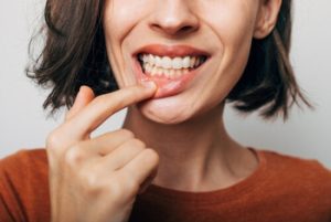 can popping a gum abscess kill you